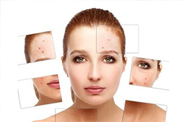 Acne treatment at Nitson Homeopathy